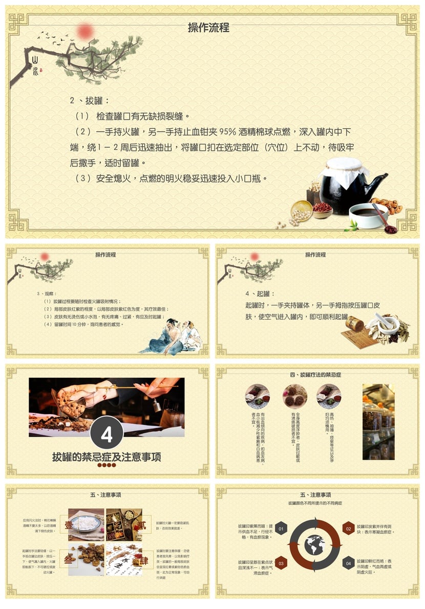 中医养生PPT模板 拔罐疗法护理操作素材 中医文化课件 - 第3页预览